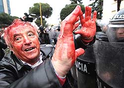 ALBANIA CLASHES