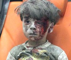Il piccolo Omran Daqneesh, di Aleppo