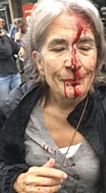 Una donna manganellata dalla polizia a Barcellona