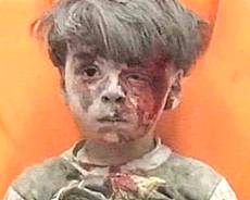 Omran Daqneesh