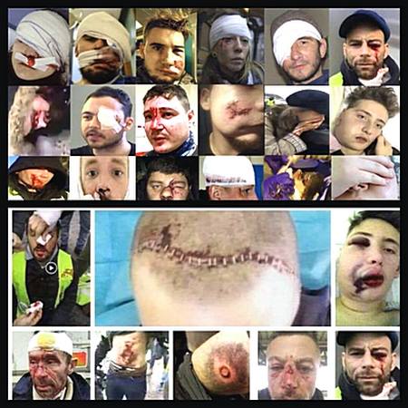 Gilet Gialli massacrati dalla polizia di Macron